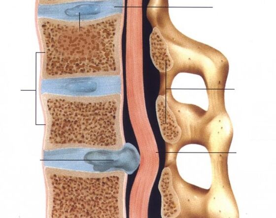 The hernias are pronounced