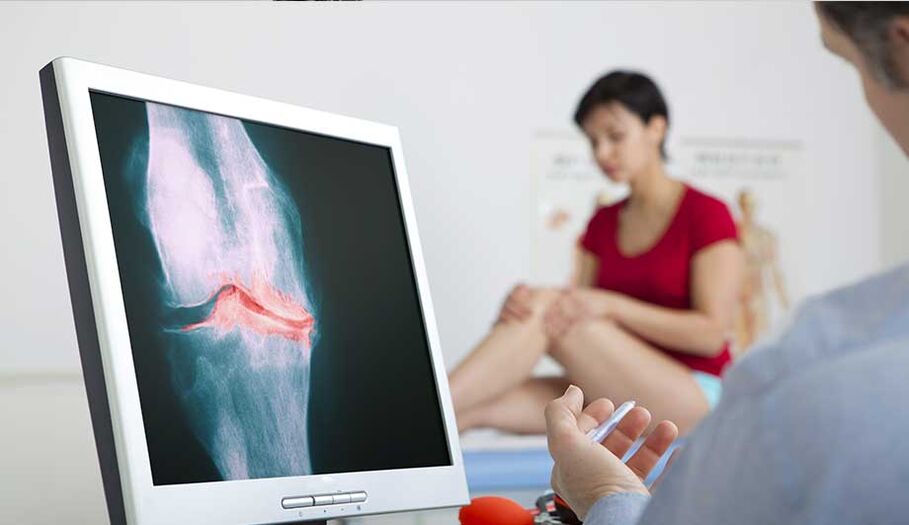 Consultation with a doctor if arthritis or arthrosis is suspected