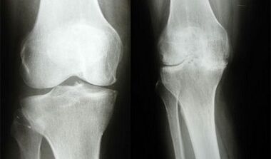 knee diagnosis methods